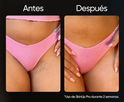 Depiladora SkinUp Pro