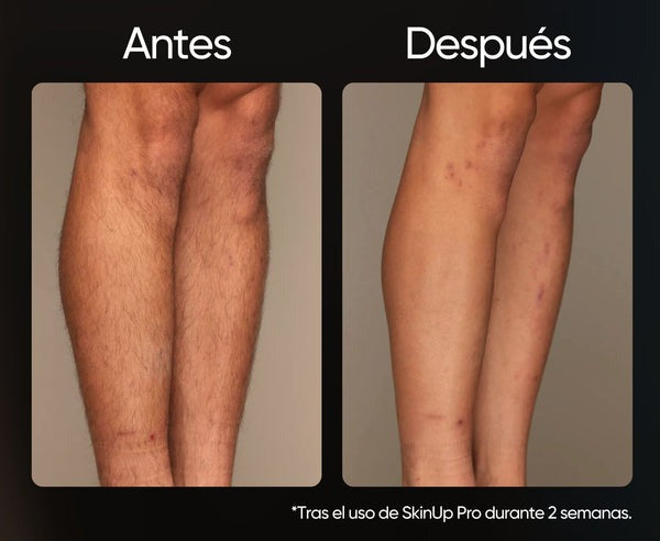Depiladora SkinUp Pro